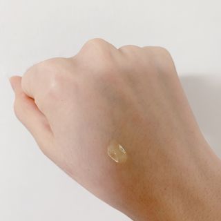 히루스카 포스트아크네 클리어 — 5점을 준 리뷰어가 2021년 1월 올린 사용 사진