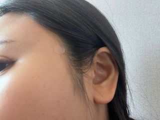 [큐어반H 스팟] 자외선 99프로 차단되는 스틱타입 스팟밴드(1팩 / 66매입) — 5점을 준 리뷰어가 2022년 12월 올린 사용 사진