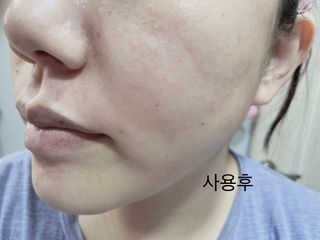 렉스리 닥터 올인원 세럼 Rexri Dr.All-in-one Serum — 4점을 준 리뷰어가 2021년 8월 올린 사용 사진