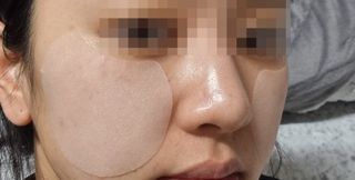 리더스코스메틱 리더스 카밍 바이오틱스 퀵 수딩 패드 — 5점을 준 리뷰어가 2022년 5월 올린 사용 사진