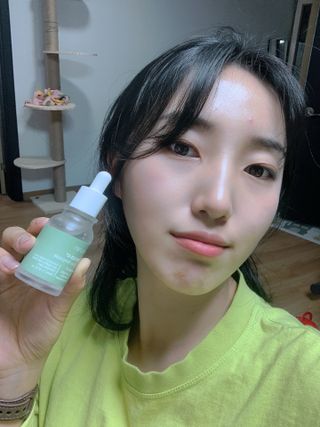 나나스킨 콤플렉스씨쓰리닥터클리어앰플 — 3.5점을 준 리뷰어가 2021년 3월 올린 사용 사진
