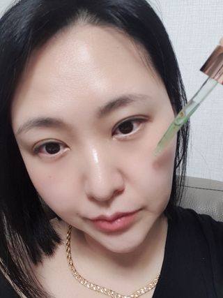 애디팬더 미생물 바이오 SF앰플 블루/그린 — 5점을 준 리뷰어가 2021년 4월 올린 사용 사진