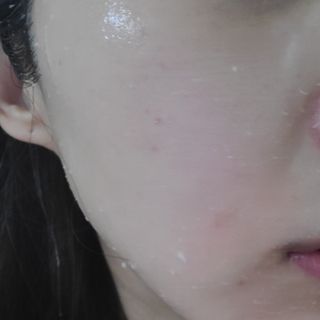 오띠 카렌듈라 LHA 마일드 필링 젤(120ml) — 5점을 준 리뷰어가 2021년 4월 올린 사용 사진