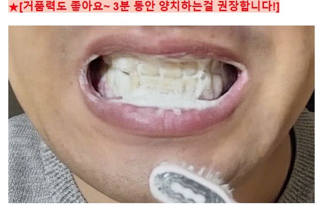 유해균 뿐만 아니라 유익균까지 씻어내는 치약은 그만, 건강한 구강환경을 만드는 덴탈엔오 리뷰 사진
