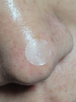 세뚜아(Cettua) 세뚜아 스팟 클리어 듀얼 패치 Cettua Spot Clear Dual Patch — 5점을 준 리뷰어가 2023년 7월 올린 사용 사진