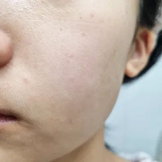 세뚜아(Cettua) [세뚜아] 포레스트 수딩 마스크 Cettual Forest  Soothing Mask 5매 — 4점을 준 리뷰어가 2024년 1월 올린 사용 사진