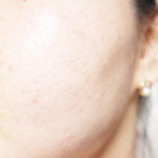 송린깡님이 올린 리뷰 사진 4