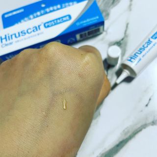 히루스카 포스트아크네 클리어 — 4점을 준 리뷰어가 2021년 2월 올린 사용 사진