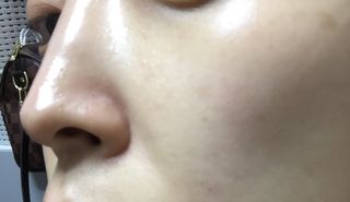 [미릴] 맑음빛 레드빈 브라이트닝 앰플 — 5점을 준 리뷰어가 2021년 1월 올린 사용 사진