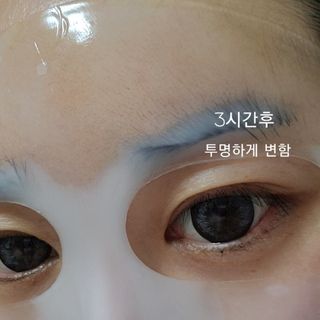 101스킨 영앤리치 하이드로겔 마스크팩 — 5점을 준 리뷰어가 2021년 2월 올린 사용 사진