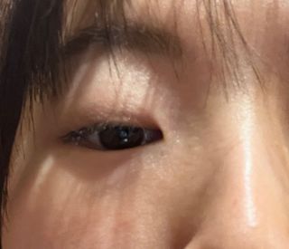 나우 [리브엠] 123억개 엑소좀으로 채운 눈부신 광채, 엑소코어 화이트닝 텐션 앰플 — 5점을 준 리뷰어가 2023년 11월 올린 사용 사진