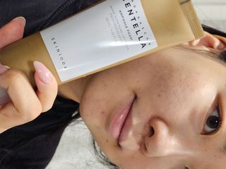 스킨1004 [SKIN1004] 마다가스카르 센텔라 앰플 폼 125ml — 5점을 준 리뷰어가 2024년 8월 올린 사용 사진