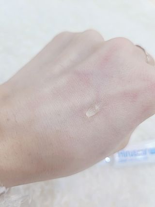히루스카 포스트아크네 클리어 — 5점을 준 리뷰어가 2021년 2월 올린 사용 사진