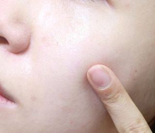 랑팡 병풀추출물150ml+어성초추출물150ml+스킨빅패드60매 — 5점을 준 리뷰어가 2021년 10월 올린 사용 사진