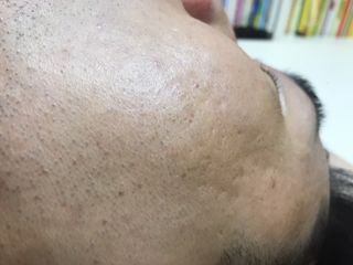 BRMUD 리커버리 머드 마스크 — 5점을 준 리뷰어가 2021년 8월 올린 사용 사진