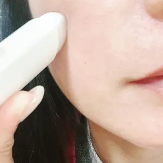 트윙클라 안티멜라 수딩 워터밤 — 5점을 준 리뷰어가 2022년 6월 올린 사용 사진
