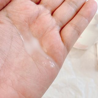 바이오오일 [바이오-오일] 바디 로션 175ml — 5점을 준 리뷰어가 2021년 10월 올린 사용 사진