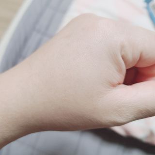 히루스카 포스트아크네 클리어 — 5점을 준 리뷰어가 2021년 2월 올린 사용 사진