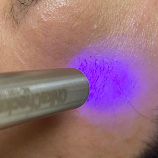 메데스 비츠케어 모공케어 피부관리키트 — 5점을 준 리뷰어가 2021년 6월 올린 사용 사진