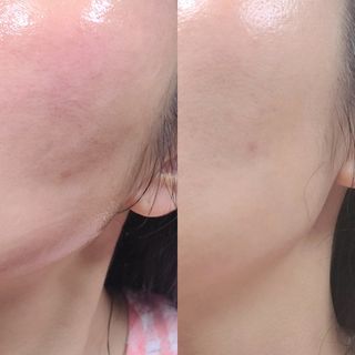 랑팡 EGF+FGF 10ppm 리포좀 앰플 원액 10ml — 5점을 준 리뷰어가 2021년 10월 올린 사용 사진