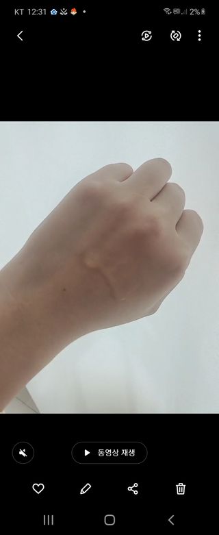 나나스킨 콤플렉스씨쓰리닥터클리어앰플 — 5점을 준 리뷰어가 2021년 9월 올린 사용 사진