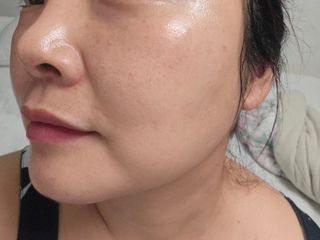 하이브리온 [쿠팡 구매평] 닥터초이스 멜라제로 스템셀 엑소좀 화이트닝 앰플 40g , 1개 — 5점을 준 리뷰어가 2025년 5월 올린 사용 사진