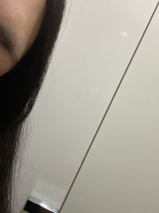 올리브영 엘라밴드 하이드로 도트 스팟패치 12mm, 티트리 — 5점을 준 리뷰어가 2022년 9월 올린 사용 사진