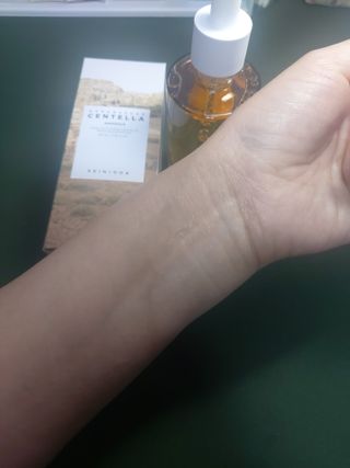 [스킨1004] 마다가스카르 센텔라 앰플 100ml — 5점을 준 리뷰어가 2024년 5월 올린 사용 사진