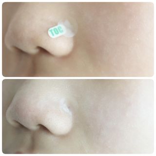 [큐어반H 스팟] 자외선 99프로 차단되는 스틱타입 스팟밴드(1팩 / 66매입) — 5점을 준 리뷰어가 2022년 12월 올린 사용 사진