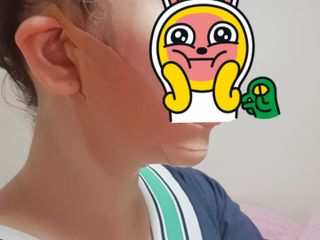 아이디플라코스메틱 아이디 페이스핏 마이너스 밴드 v2 — 5점을 준 리뷰어가 2021년 6월 올린 사용 사진