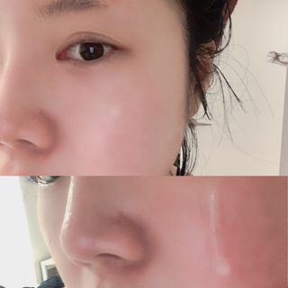 나나스킨 콤플렉스씨쓰리닥터클리어앰플 — 5점을 준 리뷰어가 2021년 10월 올린 사용 사진
