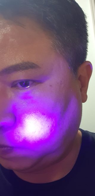 메데스 비츠케어 모공케어 피부관리키트 — 4점을 준 리뷰어가 2021년 8월 올린 사용 사진