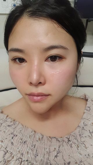 바이리뮤 에이지 홀딩 펩타톡스 앰플 — 5점을 준 리뷰어가 2021년 1월 올린 사용 사진