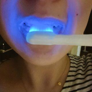 트로마츠 심플 미세전류 칫솔 — 5점을 준 리뷰어가 2022년 5월 올린 사용 사진