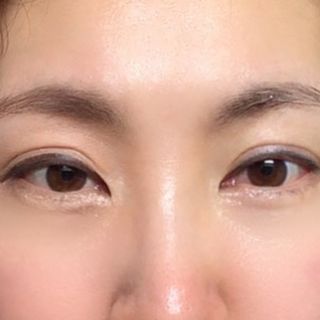 키노닉스 카모 클렌징 패드 — 5점을 준 리뷰어가 2021년 8월 올린 사용 사진