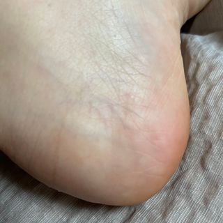 미라클풋 유리발각질제거기 물없이 쓱싹쓱싹 몇번만에 발각질 완벽제거 — 5점을 준 리뷰어가 2021년 8월 올린 사용 사진