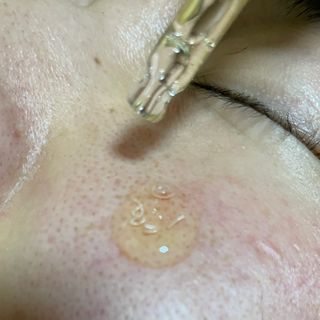 바이리뮤 에이지 홀딩 펩타톡스 앰플 — 5점을 준 리뷰어가 2021년 4월 올린 사용 사진