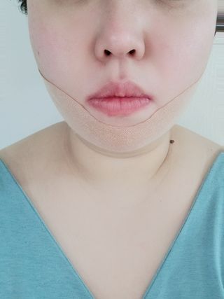아이디플라코스메틱 아이디 페이스핏 마이너스 밴드 v2 — 5점을 준 리뷰어가 2020년 12월 올린 사용 사진