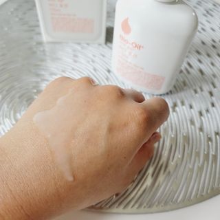 바이오오일 [바이오-오일] 바디 로션 175ml — 5점을 준 리뷰어가 2021년 11월 올린 사용 사진
