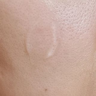 프리 [닥터문] 프리미엄 알로에베라 시카 수딩젤 1000ml — 5점을 준 리뷰어가 2024년 12월 올린 사용 사진