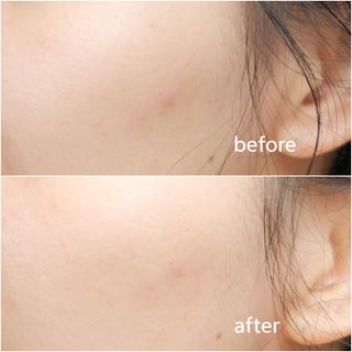 나우 [리브엠] 123억개 엑소좀으로 채운 눈부신 광채, 엑소코어 화이트닝 텐션 앰플 — 5점을 준 리뷰어가 2023년 11월 올린 사용 사진