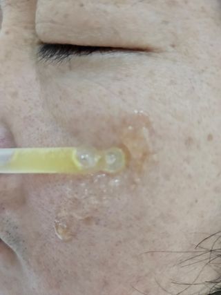 코매료 셀인키 리바이탈 퍼펙트 세럼 2종(천연오일100프로+순수비타민c150,000ppm) — 5점을 준 리뷰어가 2024년 2월 올린 사용 사진