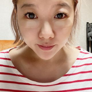 마이디플러스 트리플부스팅, 트러블 릴리프 케어 마이크로 패치 2종 중 택1 — 5점을 준 리뷰어가 2021년 11월 올린 사용 사진