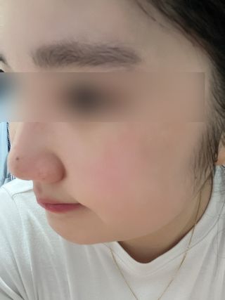 나우 [리브엠] 화해 1등 클렌징 파우더! 모공&피지 말끔순삭 — 5점을 준 리뷰어가 2023년 7월 올린 사용 사진