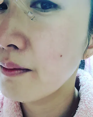 피지오겔 사이언수티컬즈 더 링클-스탑 백 앰플 세럼 — 4점을 준 리뷰어가 2022년 4월 올린 사용 사진