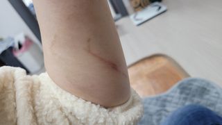 TRANDMI 트랜드미 리쥬버네이션 포스트크림 — 4.5점을 준 리뷰어가 2022년 12월 올린 사용 사진