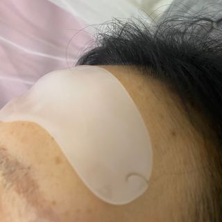 아이디플라코스메틱 아이디 페이스핏 플러스 패치 v2 — 3점을 준 리뷰어가 2020년 12월 올린 사용 사진