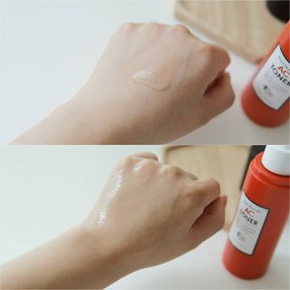 페브유 / FABYOU [페브유 2종 SET] 레드 블레미쉬 AC 토너 + AC스팟 — 5점을 준 리뷰어가 2021년 7월 올린 사용 사진