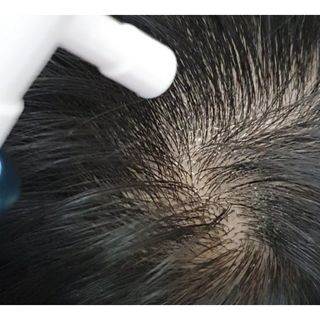 모두발라 탈모집중케어 헤어토닉 — 5점을 준 리뷰어가 2021년 12월 올린 사용 사진