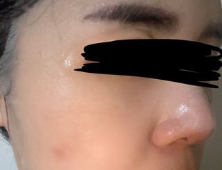 리더스코스메틱 리더스 메디유 더블 히알론10 수딩 마스크 — 5점을 준 리뷰어가 2021년 10월 올린 사용 사진